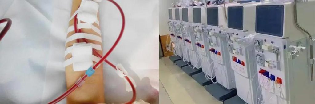 pros-and-cons-of-dialysis-for-elderly-patients