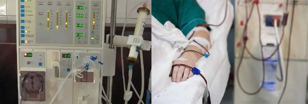 pyrogen-reaction-in-dialysis