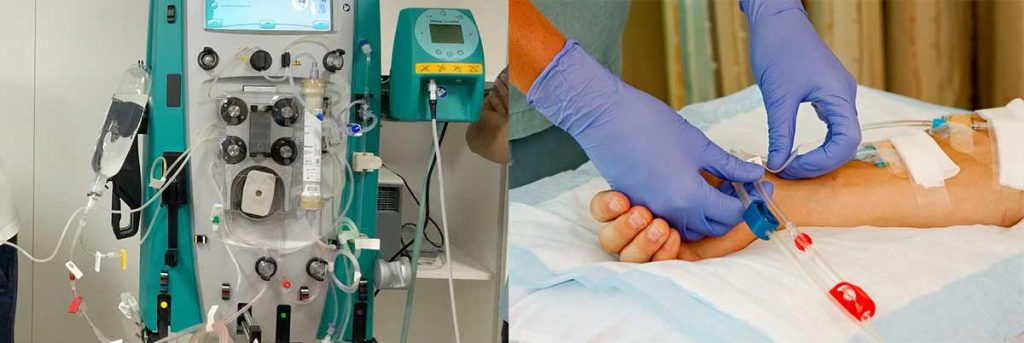water-treatment-system-in-dialysis